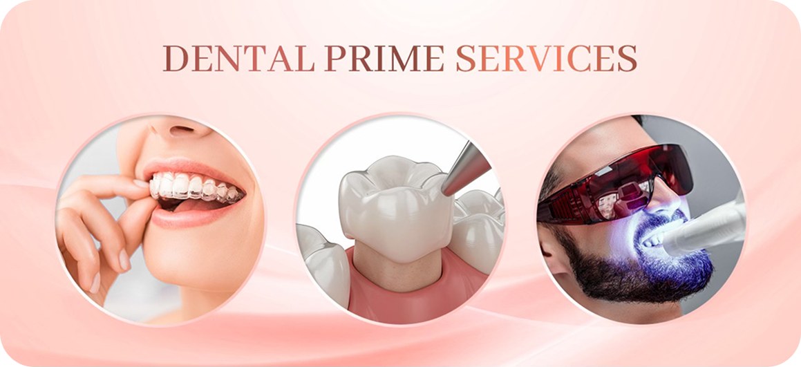 Dental Prime services — orthodontics, crowns and teeth whitening