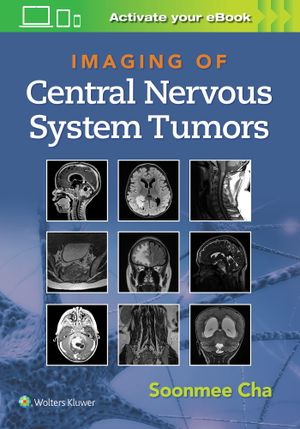 Imaging of Central Nervous System Tumors Coop Zone