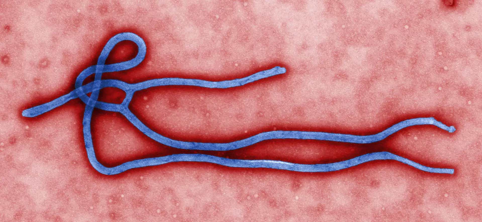 Alerta Máximo: OMS declara emergência global por surto de ebola na África Central