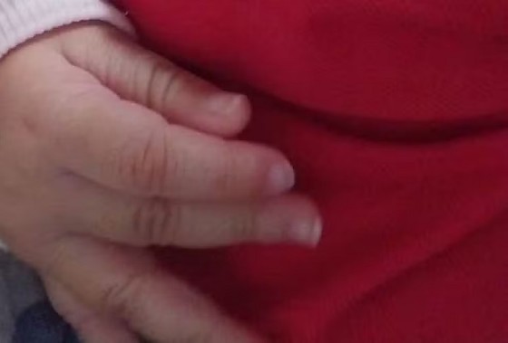 Bebê de 3 meses é a nona vítima de meningite em Mato Grosso