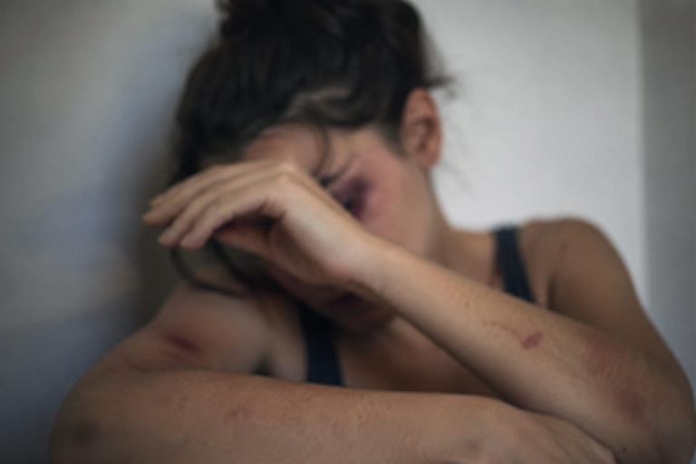 Homem é preso pela PM suspeito de agredir e arrancar lábio da esposa com uma faca
