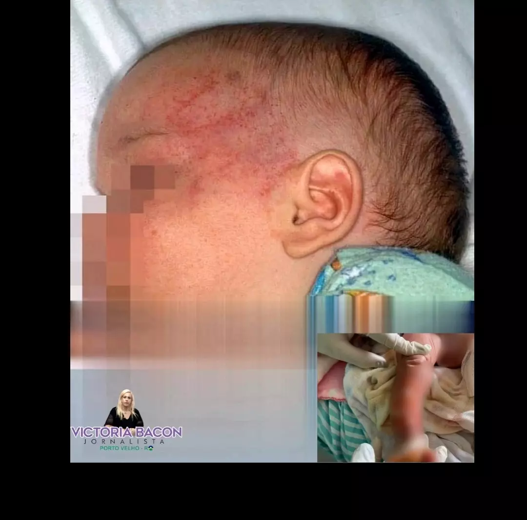 Bebê de colo é agredida violentamente pela mãe. Criança está na UTI pediátrica