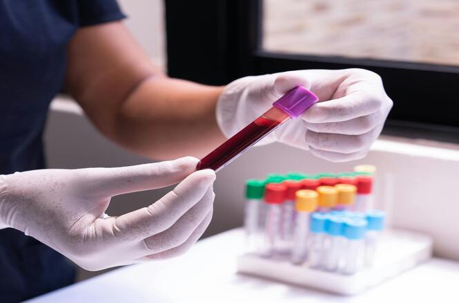 Homem é condenado a indenizar ex-companheira após transmissão do vírus HIV em SC