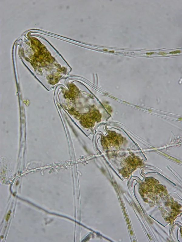 Photograph of Chaetoceros concavicornis