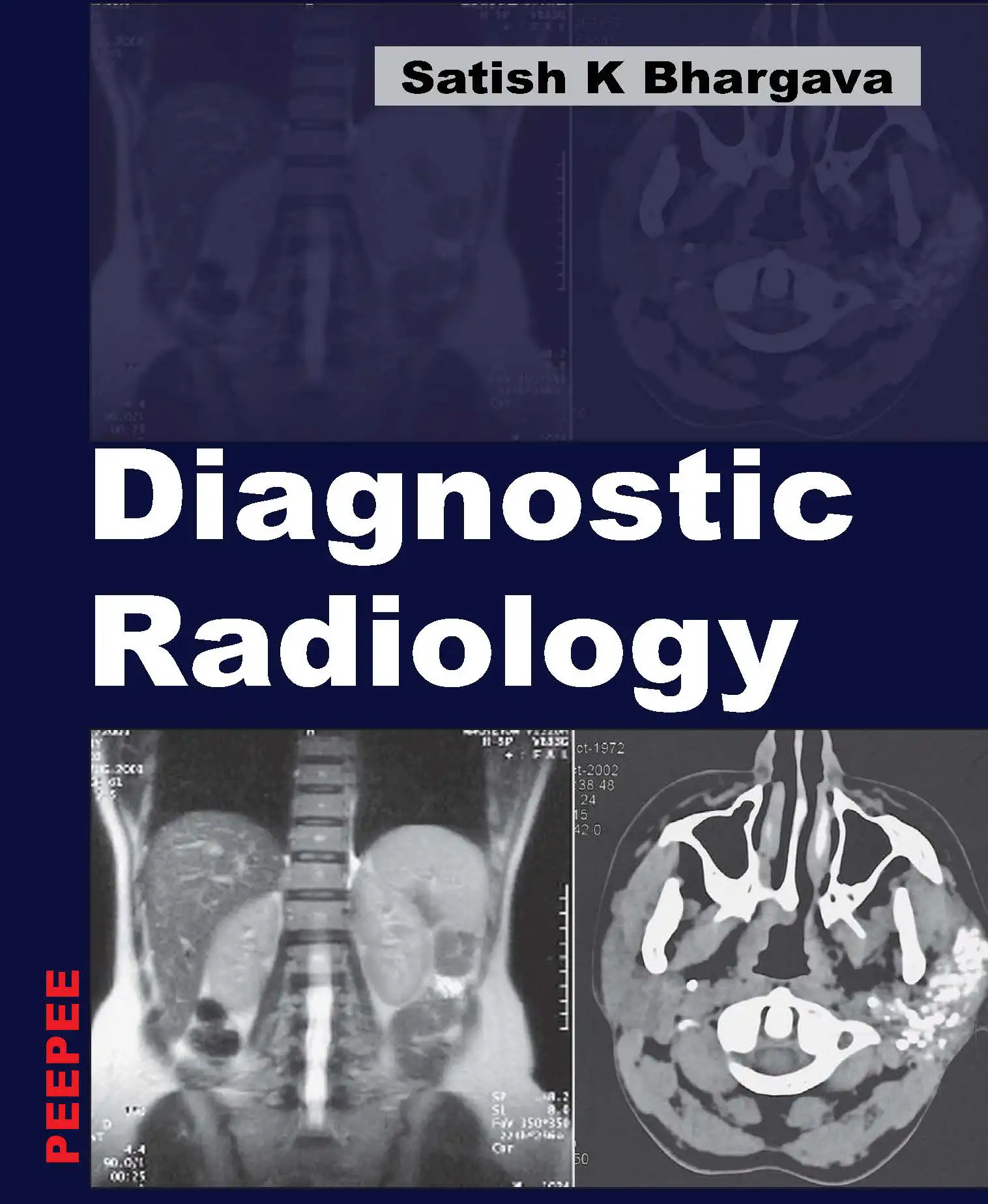 Diagnostic Radiology by Bhargava Satish K Online Calibr