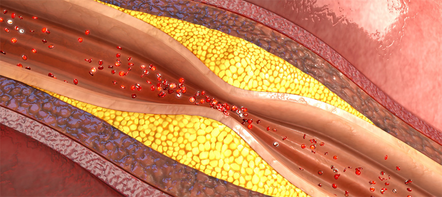 CardioAula - Médico escrevendo coração de ECG