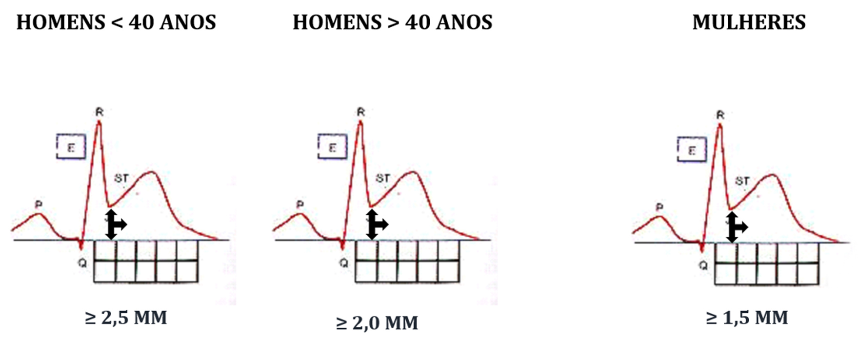 CardioAula - Médico escrevendo coração de ECG