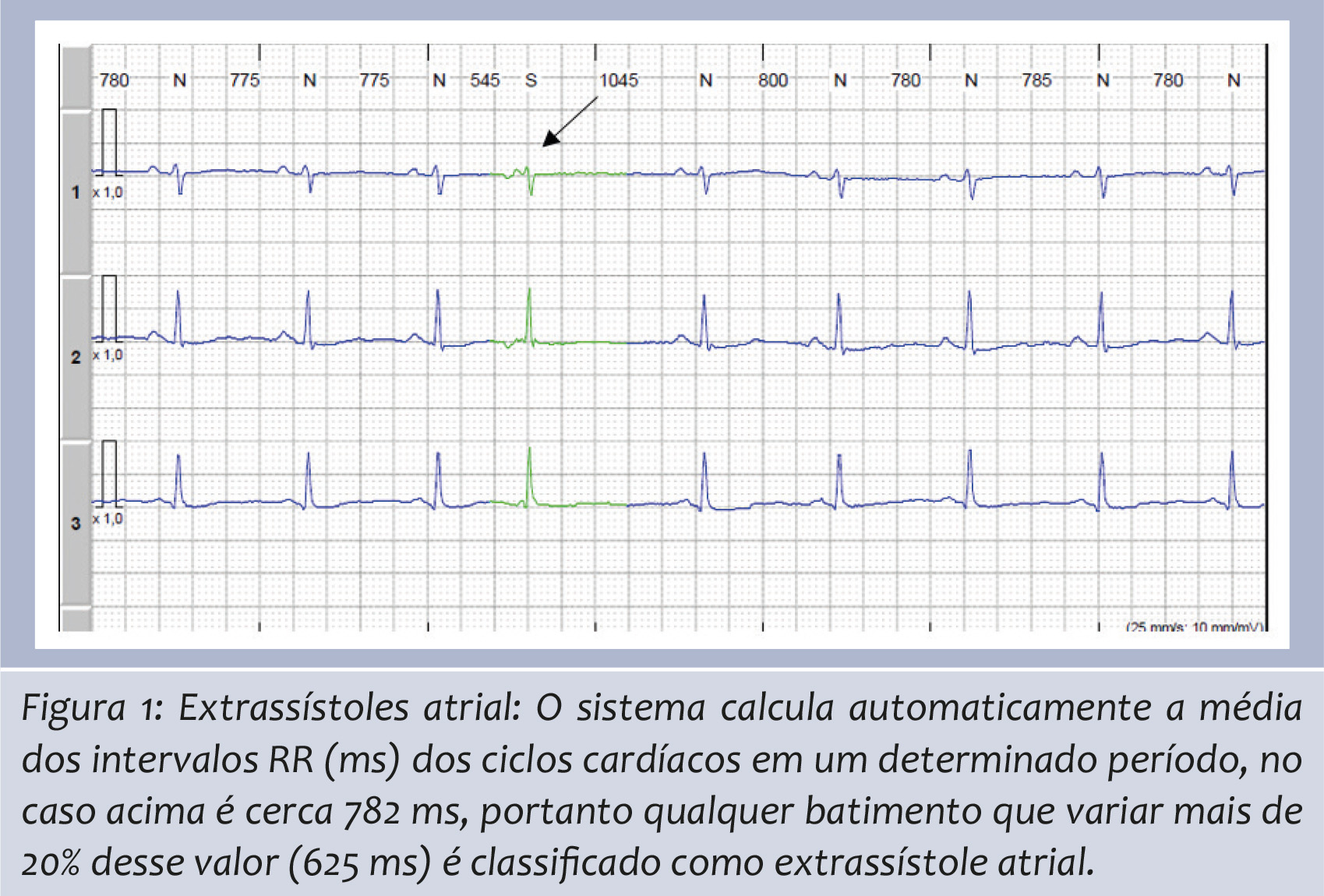 CardioAula - Médico escrevendo coração de ECG