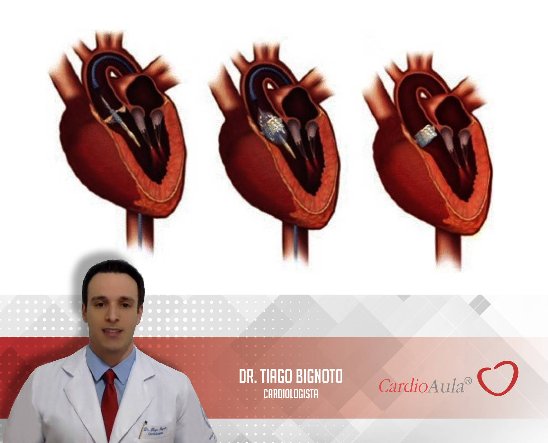 CardioAula - Médico escrevendo coração de ECG