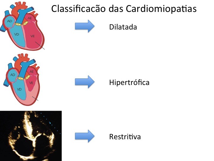 CardioAula - Médico escrevendo coração de ECG