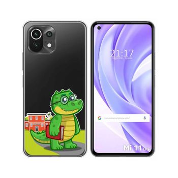 Funda Gel Transparente Xiaomi Mi 11 Lite 4g / 5g / 5g Ne Diseño Coco