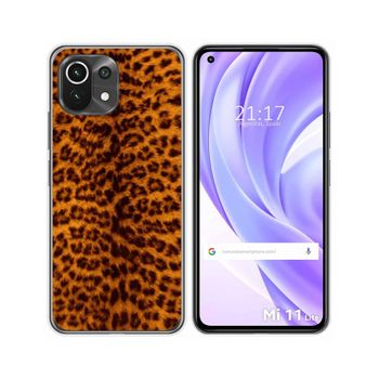 Funda Gel Tpu Xiaomi Mi 11 Lite 4g / 5g / 5g Ne Diseño Animal 03