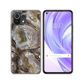 Funda Gel Tpu Xiaomi Mi 11 Lite 4g / 5g / 5g Ne Diseño Mármol 14