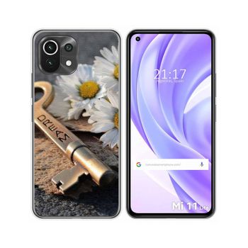 Funda Gel Tpu Xiaomi Mi 11 Lite 4g / 5g / 5g Ne Diseño Dream