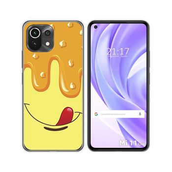 Funda Gel Tpu Xiaomi Mi 11 Lite 4g / 5g / 5g Ne Diseño Helado Vainilla