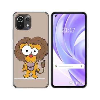 Funda Gel Tpu Xiaomi Mi 11 Lite 4g / 5g / 5g Ne Diseño Leon