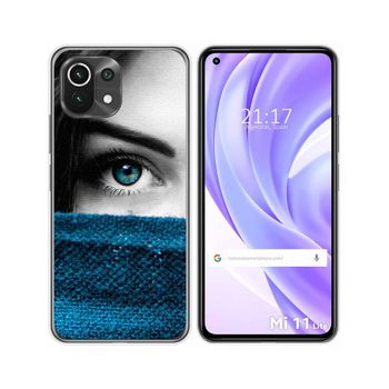 Funda Gel Tpu Xiaomi Mi 11 Lite 4g / 5g / 5g Ne Diseño Ojo