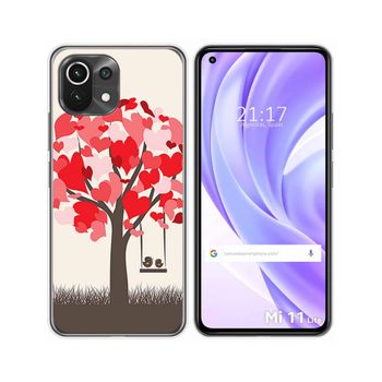 Funda Gel Tpu Xiaomi Mi 11 Lite 4g / 5g / 5g Ne Diseño Pajaritos