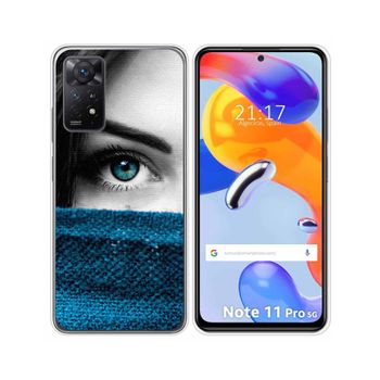 Funda Silicona Para Xiaomi Redmi Note 11 Pro / 11 Pro 5g Diseño Ojo