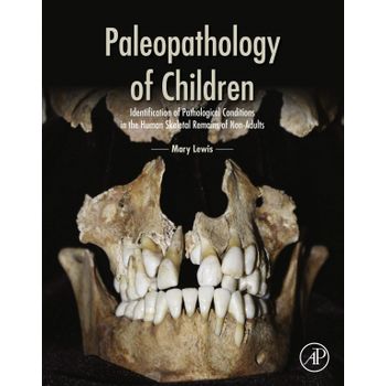 Paleopathology Of Children