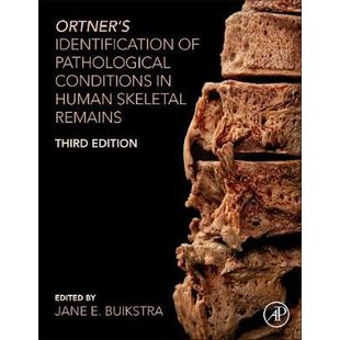 Ortner´s Identification Of Pathological Conditions Human Skeletal Reimains