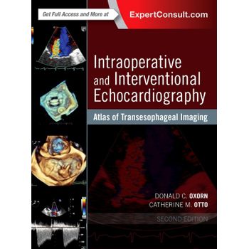 Intraoperative And Interventional Echocardiography