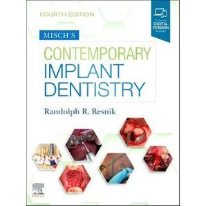 Misch´s Contemporary Implant Dentistry