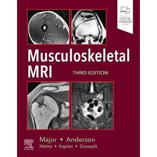 Musculoeskeletal Mri