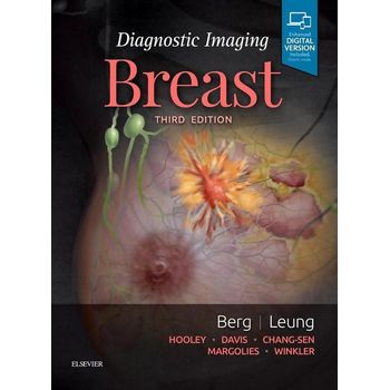 Diagnostic Imaging: Breast