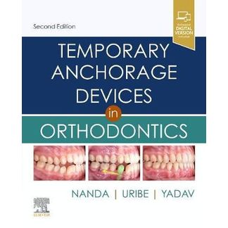 Temporary Anchorage Devices In Orthodonitcs