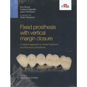 Fixed Prosthesis With Vertical Margin Closure