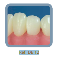 Dente Para Manequim De Dentística 12