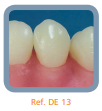 Dente Para Manequim De Dentística 13