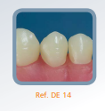 Dente Diferenciado para Manequim de Estudo 14