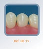 Dente 15 para Manequim de Dentística - DE 15