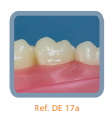 Dente Diferenciado para Manequim de Estudo 17