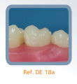 Dente Para Manequim De Dentística 18