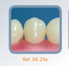 Dente 25 para Manequim de Dentística - DE 25