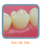 Dente Para Manequim De Dentística 26
