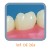 Dente 26 para Manequim de Dentística - DE 26