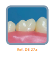 Dente Para Manequim De Dentística 27