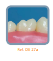 Dente Diferenciado para Manequim de Estudo 27