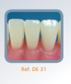 Dente Para Manequim De Dentística 31