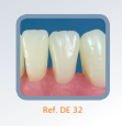 Dente Para Manequim De Dentística 32
