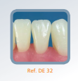 Dente Diferenciado para Manequim de Estudo 32