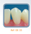 Dente Para Manequim De Dentística 33