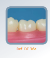 Dente Diferenciado para Manequim de Estudo 36