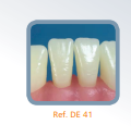 Dente Para Manequim De Dentística 41