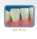 Dente Diferenciado para Manequim de Estudo 42