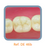 Dente Para Manequim De Dentística 46